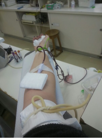 doando sangue